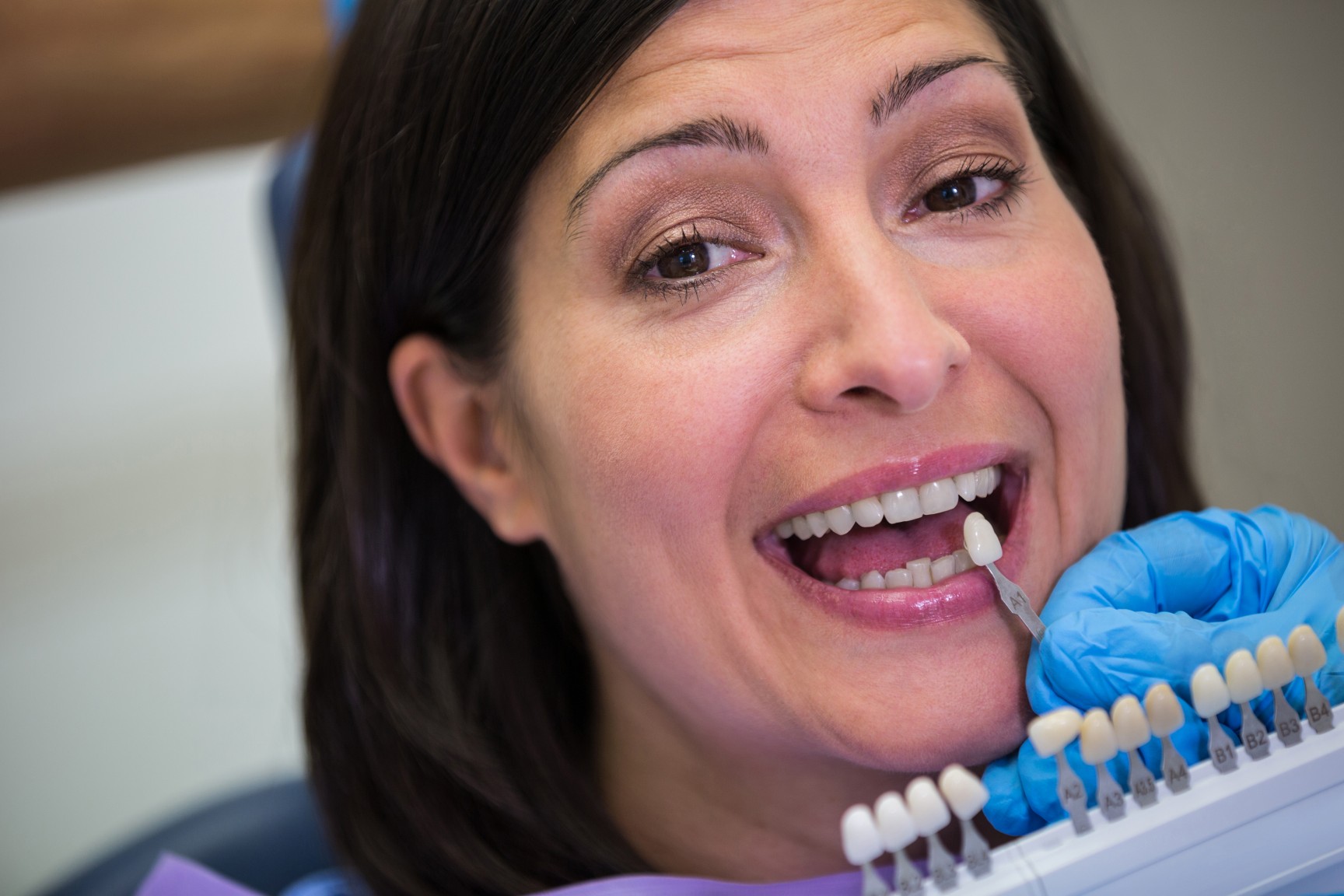 How to Care for Your Dental Implants Tips for Long-Term Success