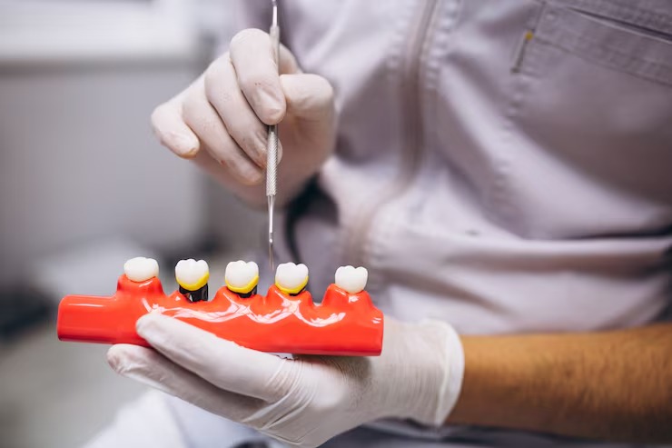 The Importance of Regular Dental Check-Ups for Dental Implant Longevity