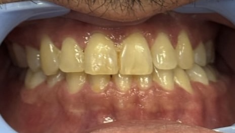 Before image