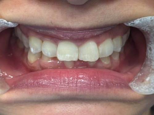 Before image