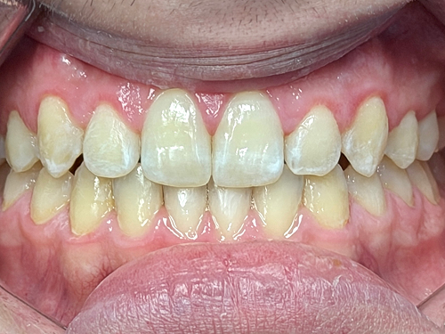 After image