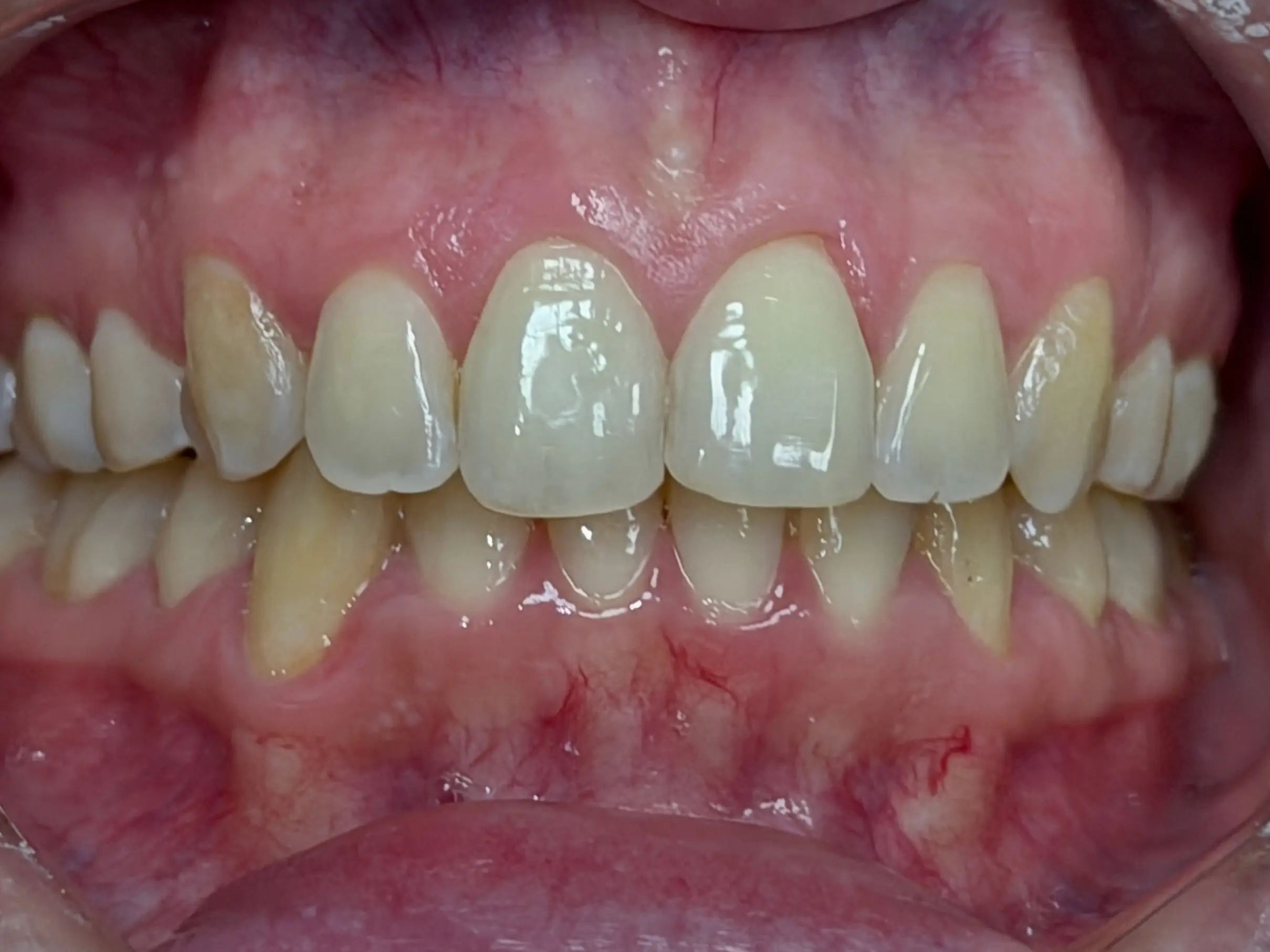 Before image