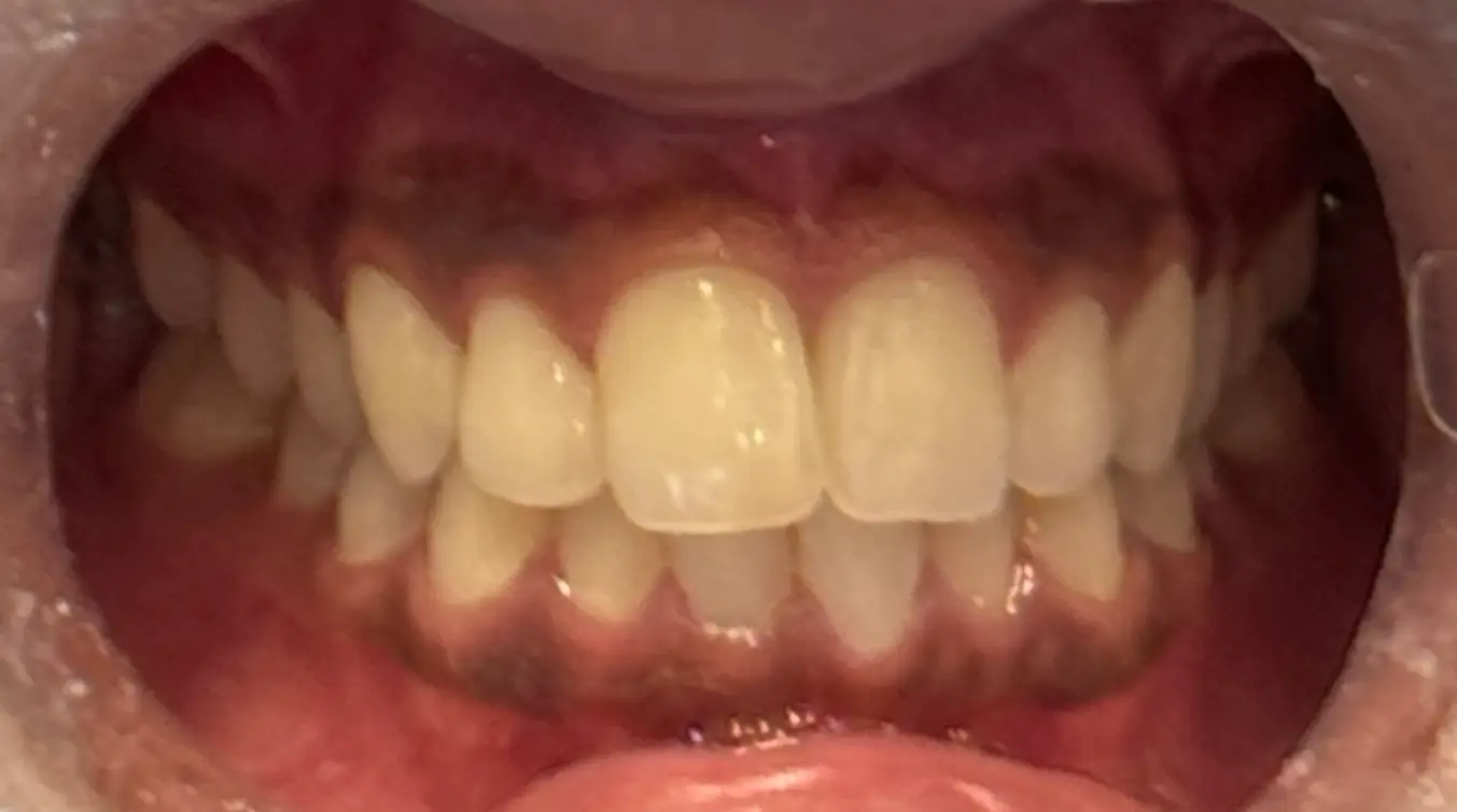 Before image