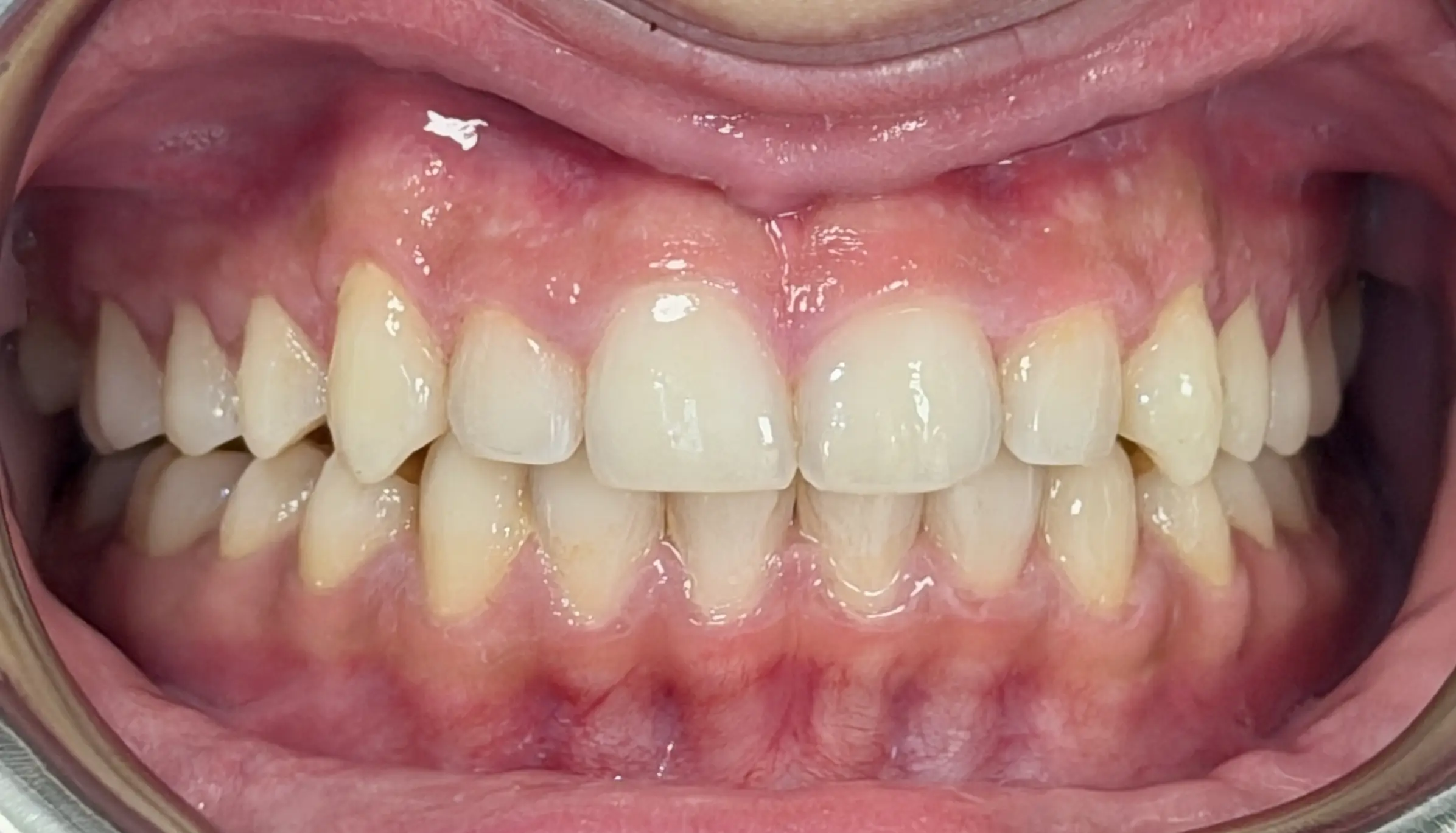 After image