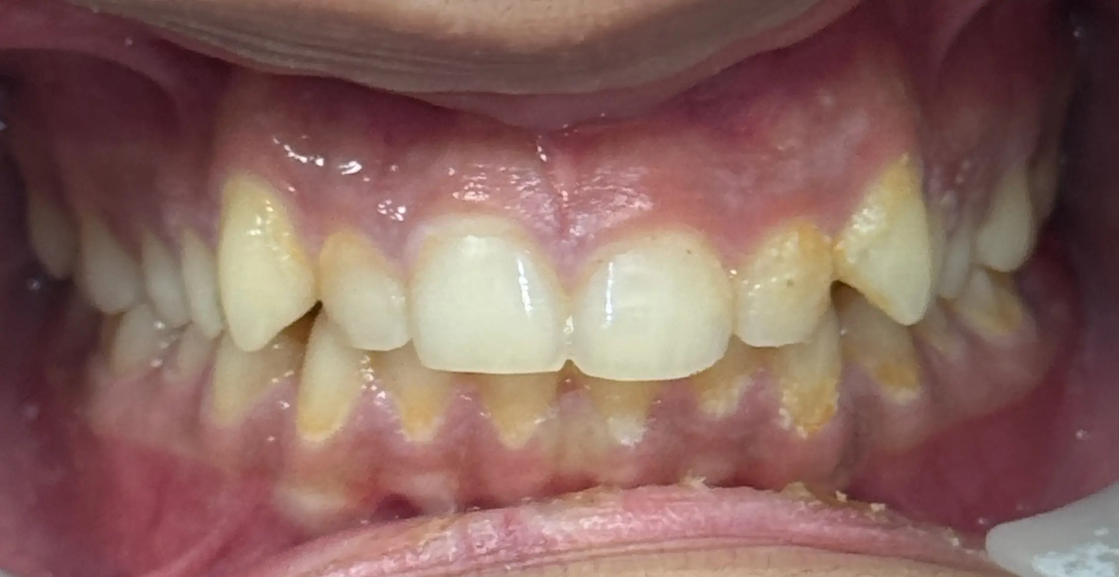 Before image